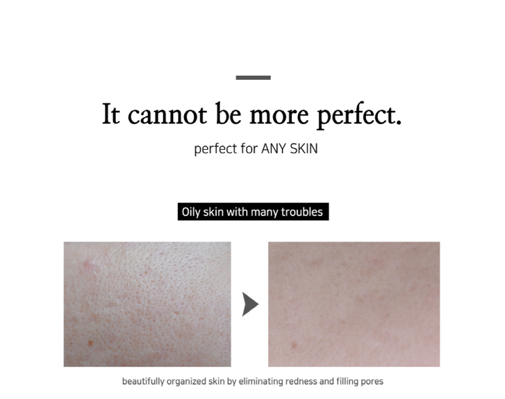 SKINNATION Triple Solution Primer 30ml | Excellent Cover Sebum control Covers skin pores Dullness Acne scars