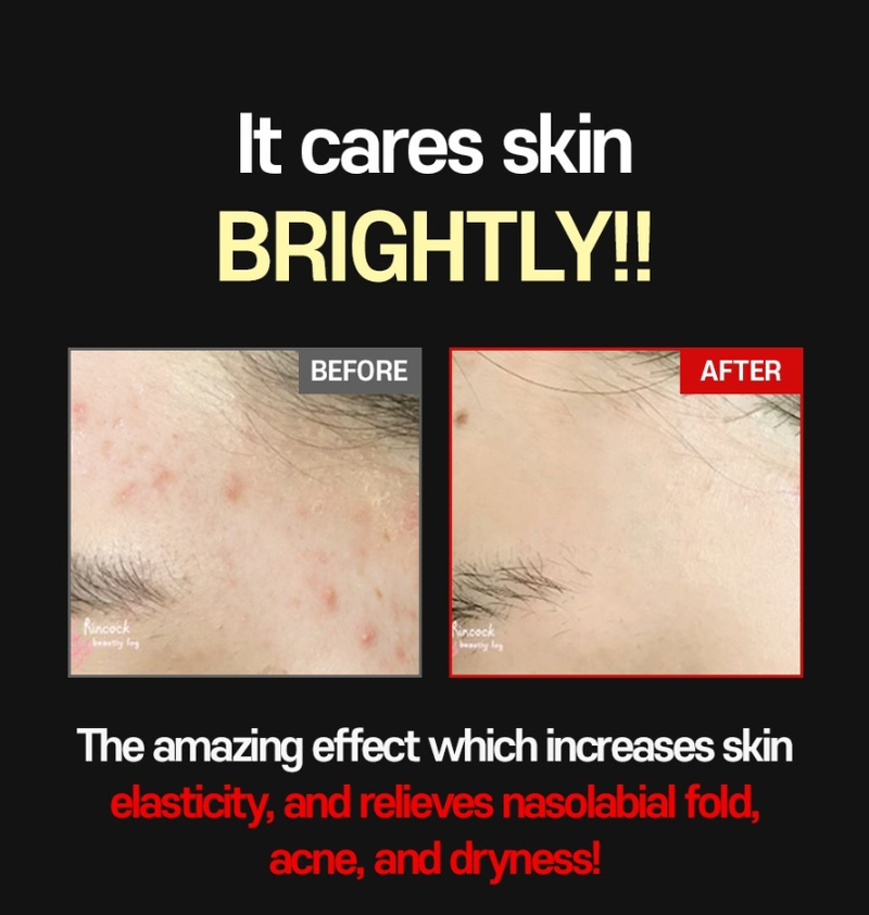 FACE FACTORY ABC Tox Gel 20ml | Pore Detox | Pore Blackhead Remover | Exfoliating Cream