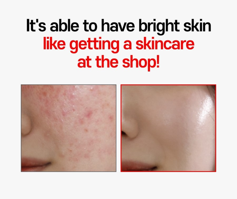 FACE FACTORY ABC Tox Gel 20ml | Pore Detox | Pore Blackhead Remover | Exfoliating Cream